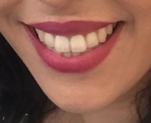Baronesa