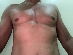 HPoa