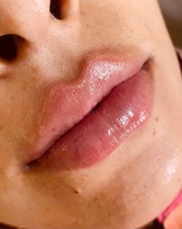 Tachinha_personal2